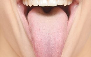 tongue