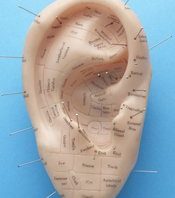 acupuncture ear meth
